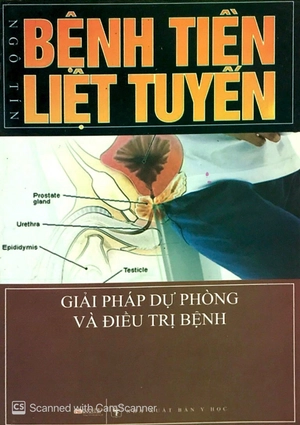 bệnh tiền liệt tuyến giải pháp dự phòng và điều trị bệnh