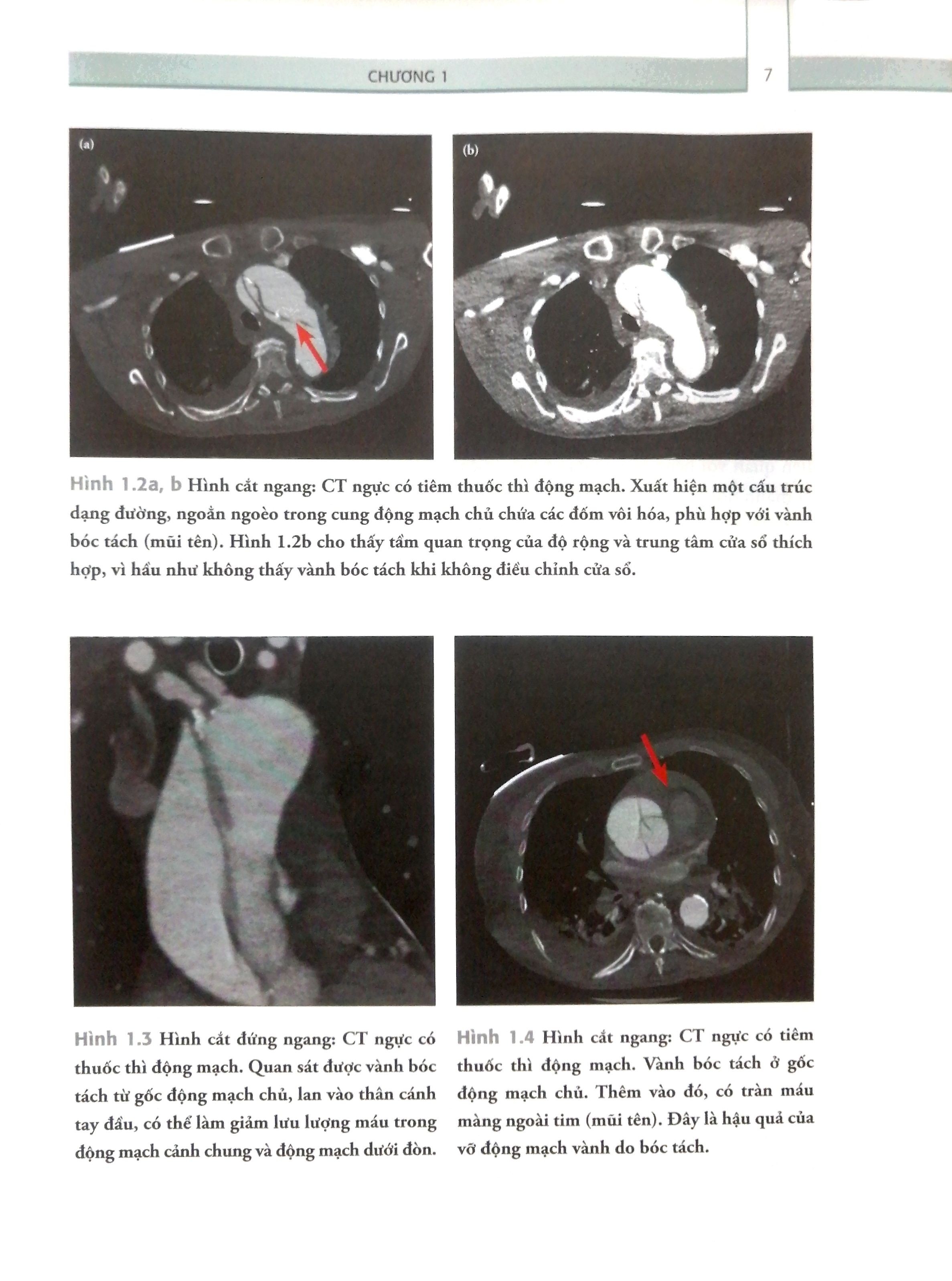 cẩm nang trực chuẩn đoán hình ảnh