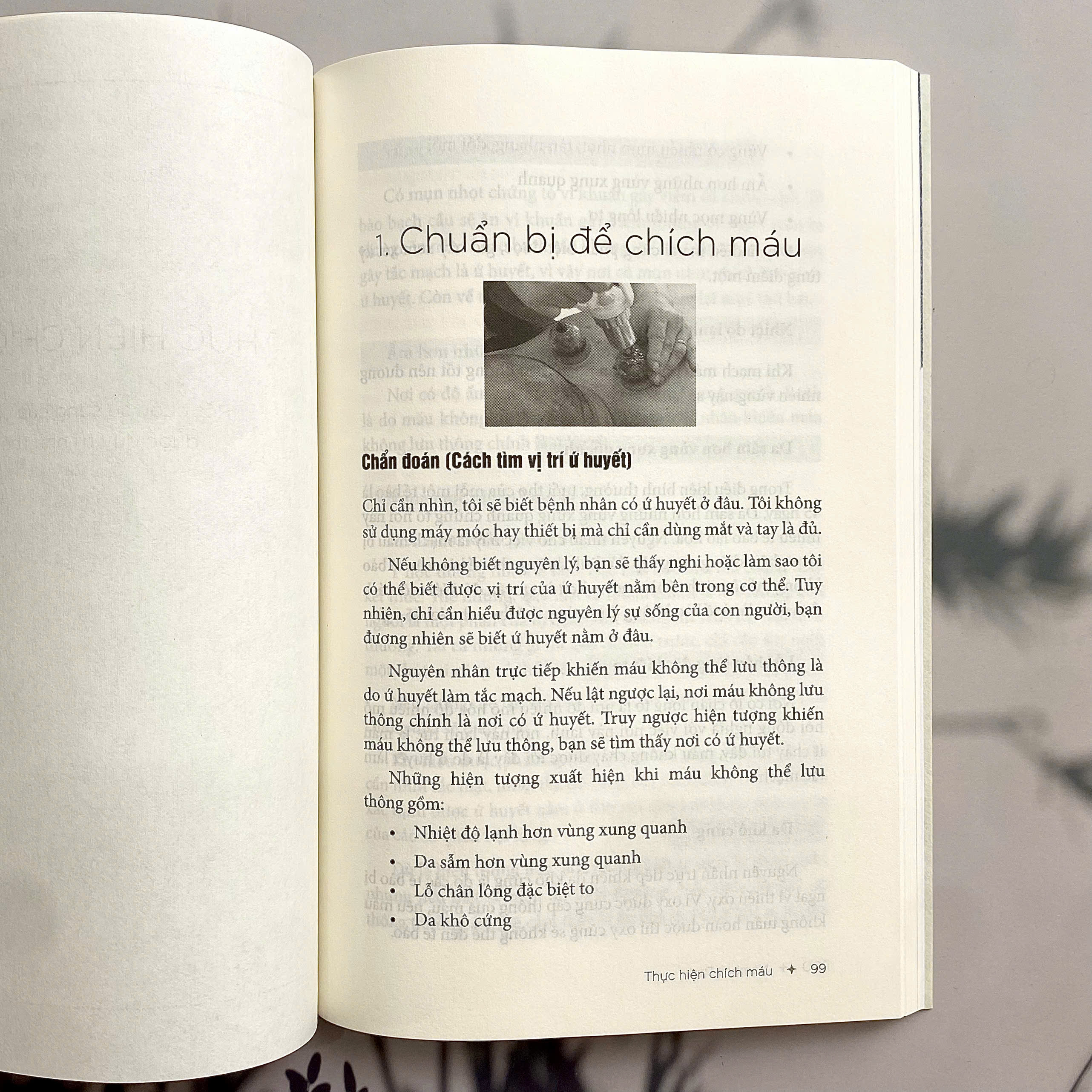 Chi Can Mau Sach Bach Benh Tieu Tan - Lieu Phap Giac Hoi Chich Mau Simcheon - Tap 1