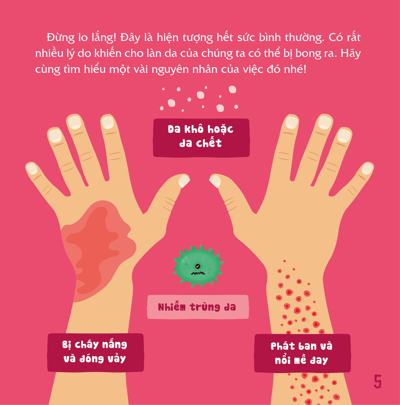 có thể bạn chưa biết - vì sao chúng ta... bị bong da?