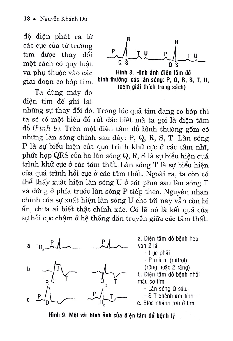 hiểu biết để phòng và trị bệnh tim mạch