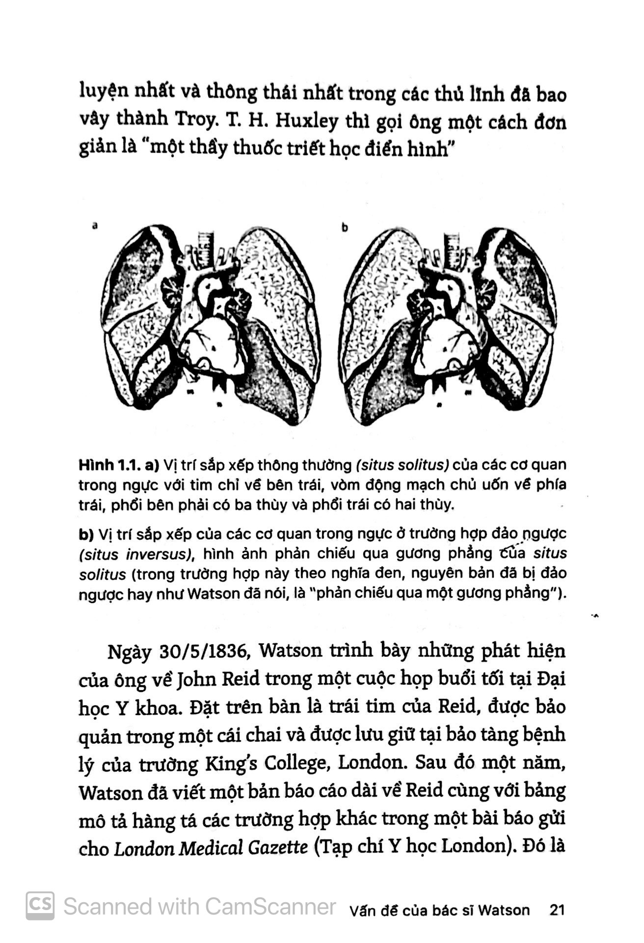 những bí ẩn của tay phải và tay trái