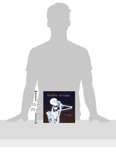 skeleton hiccups