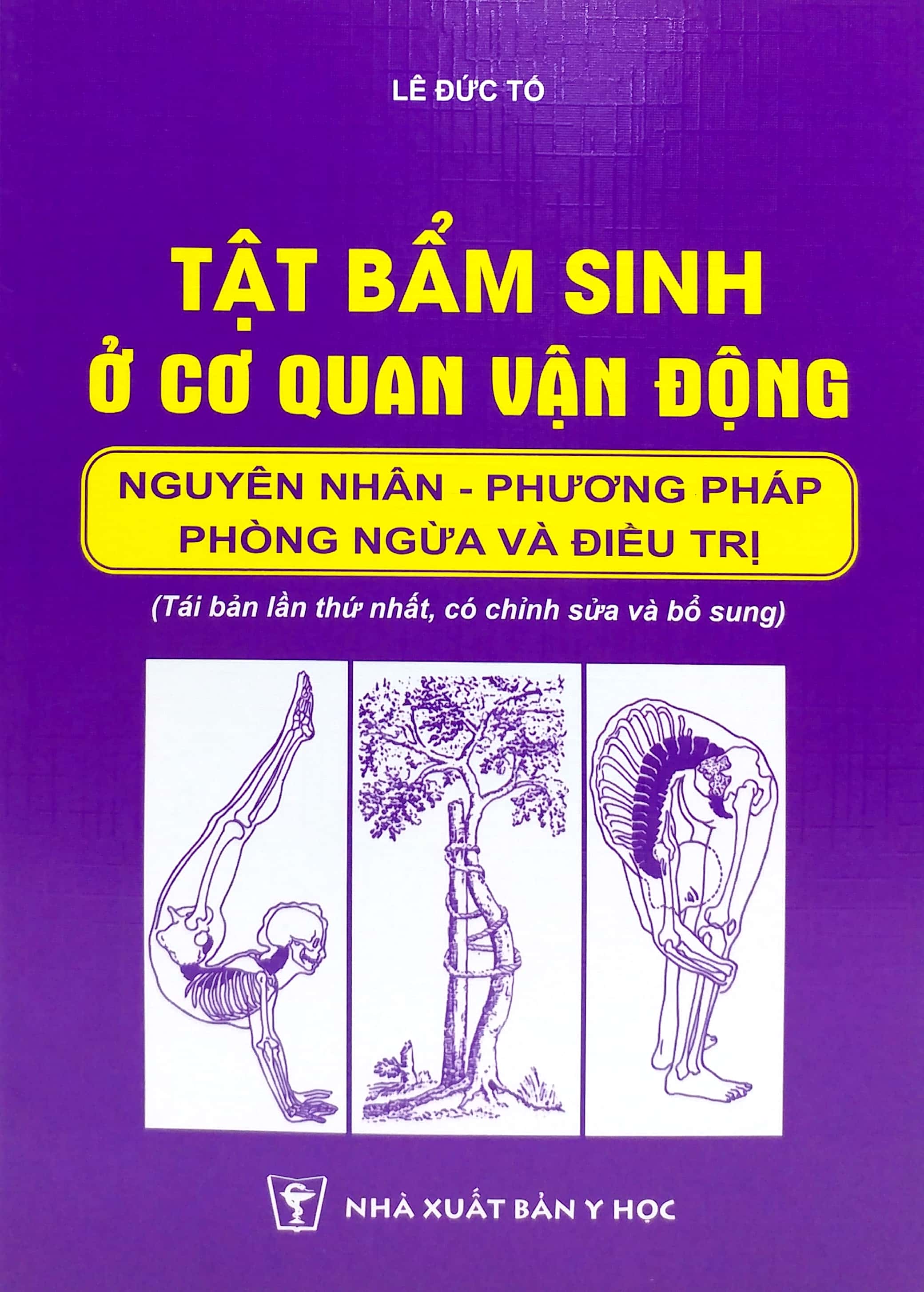 tật bẩm sinh ở cơ quan vận động - nguyên nhân - phương pháo phòng ngừa và điều trị (tái bản 2024)