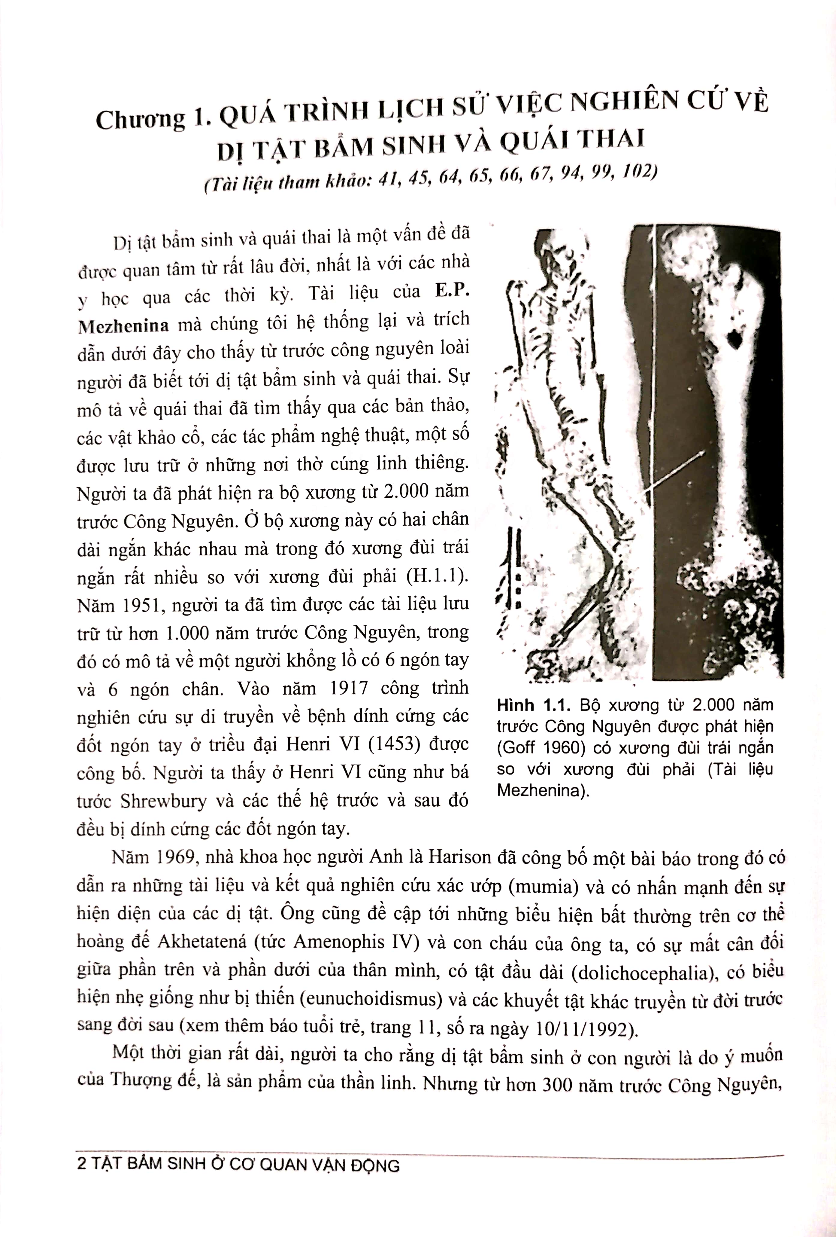tật bẩm sinh ở cơ quan vận động - nguyên nhân - phương pháo phòng ngừa và điều trị (tái bản 2024)