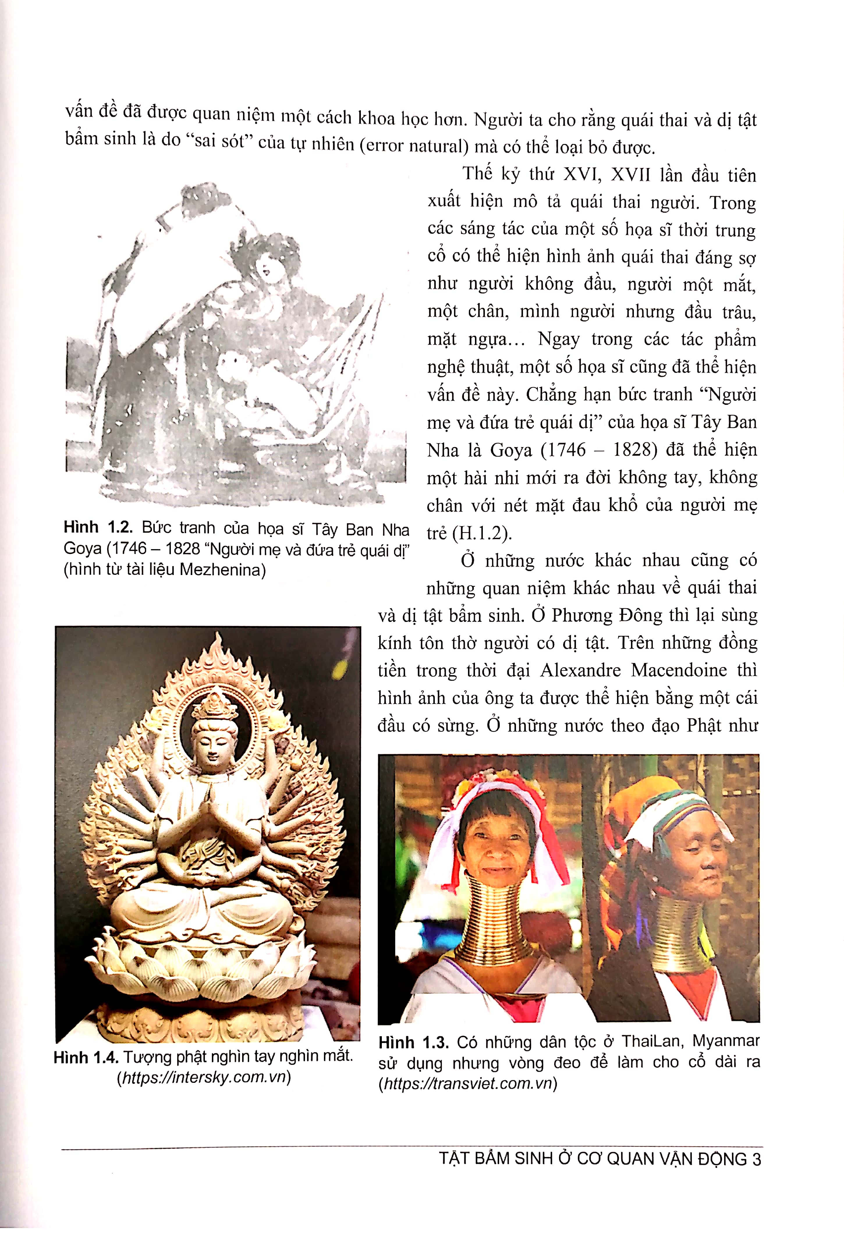 tật bẩm sinh ở cơ quan vận động - nguyên nhân - phương pháo phòng ngừa và điều trị (tái bản 2024)