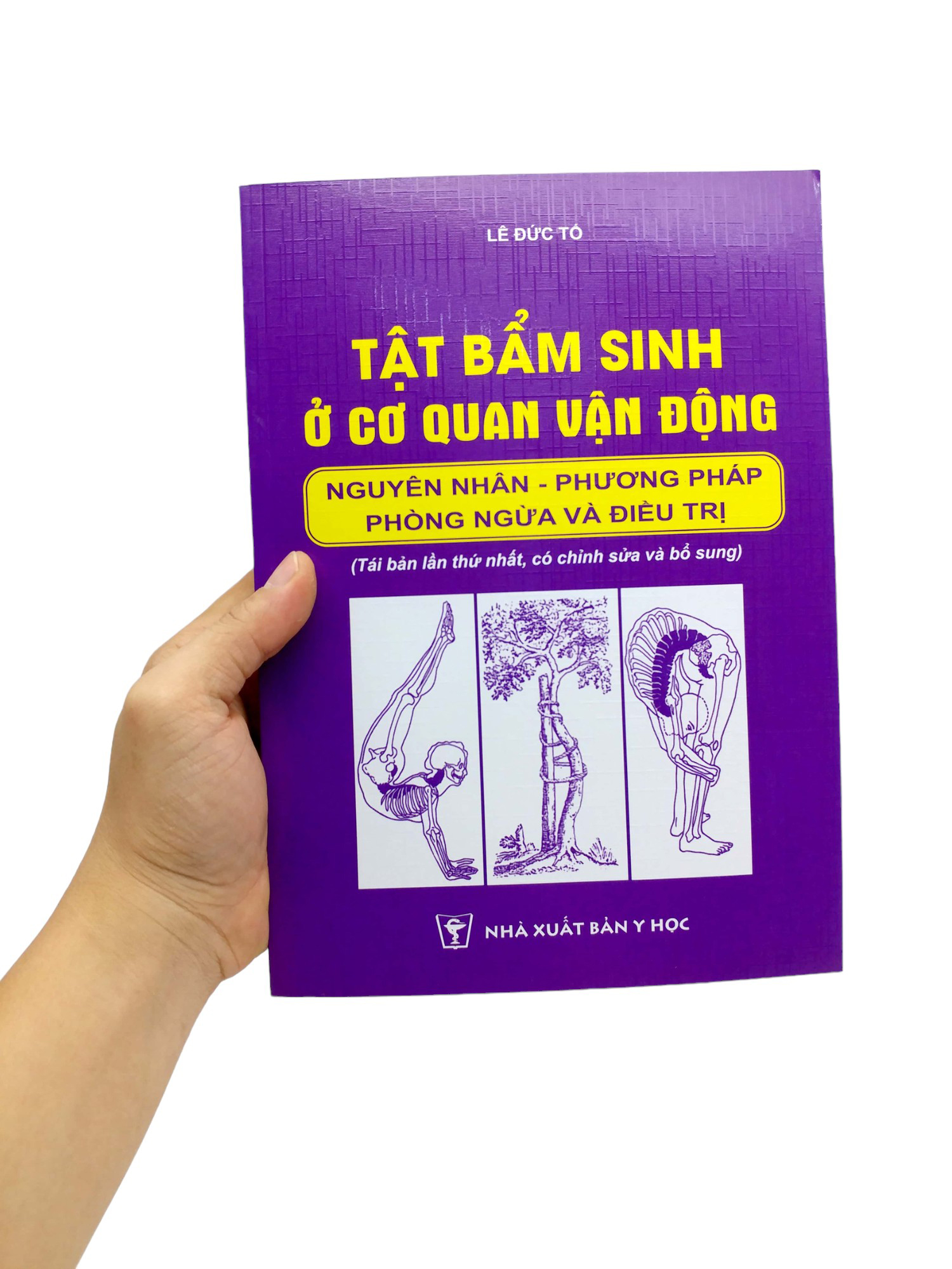 tật bẩm sinh ở cơ quan vận động - nguyên nhân - phương pháo phòng ngừa và điều trị (tái bản 2024)