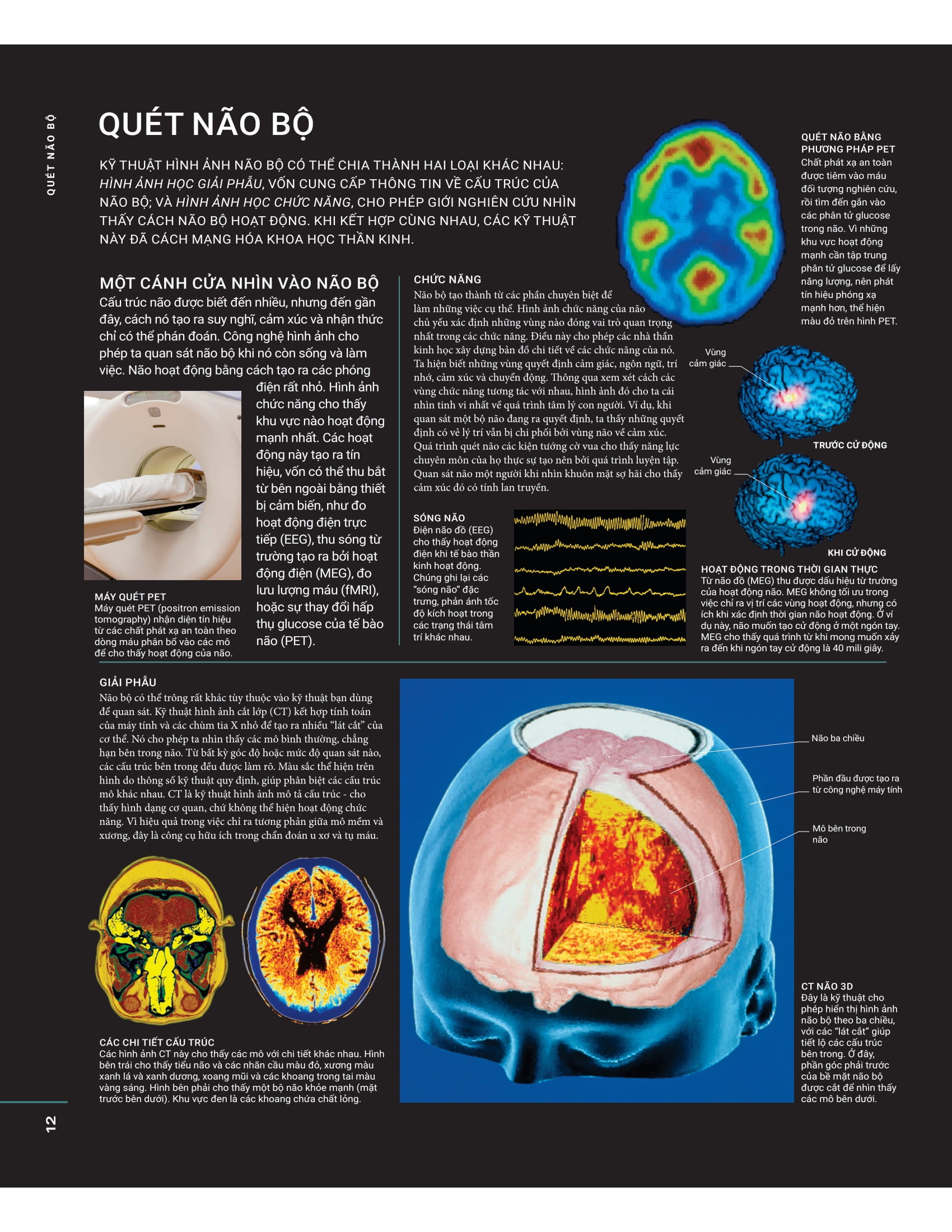 the brain book - não chúng ta có gì và làm gì? - bìa cứng