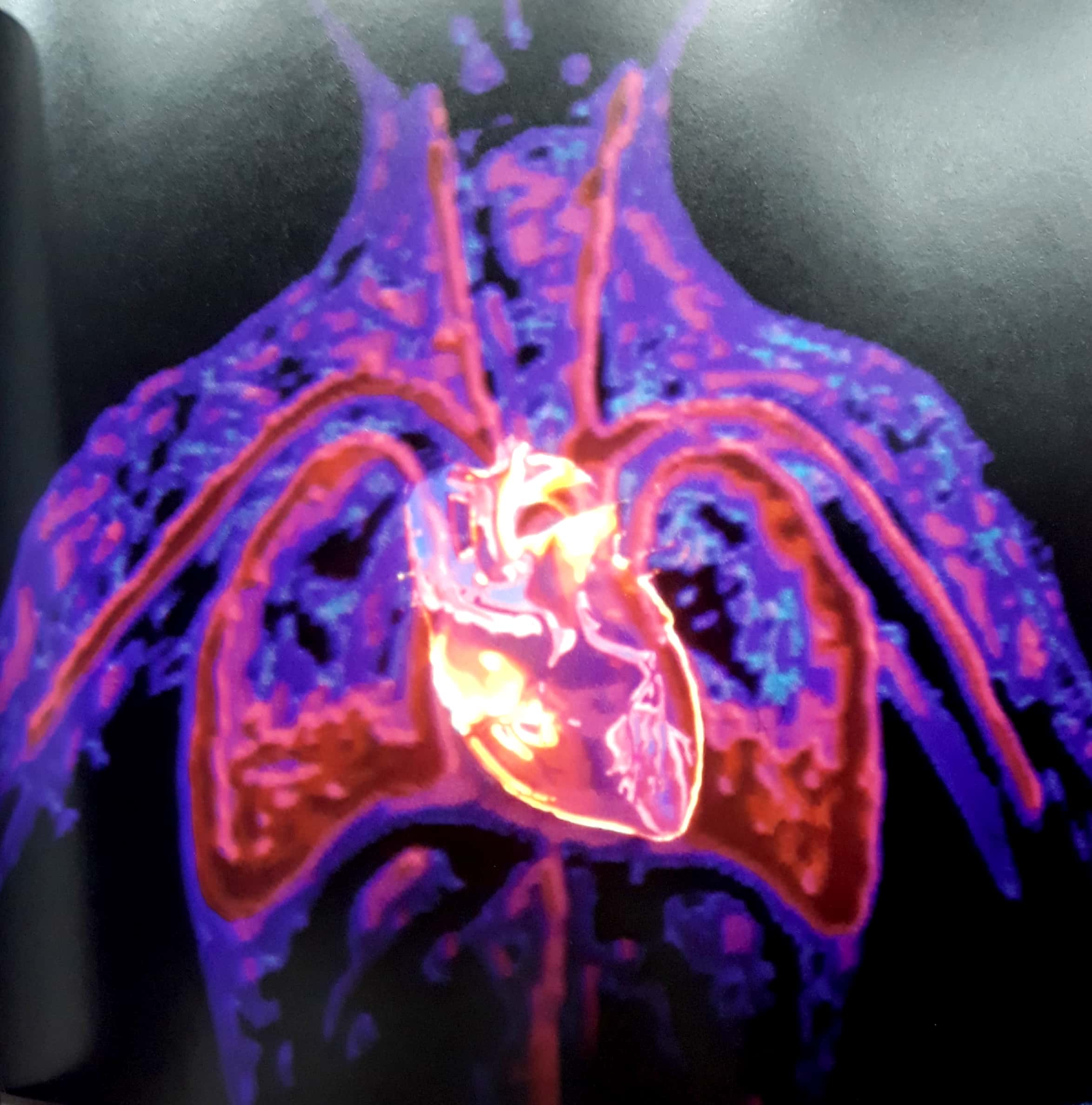 the heart: our circulatory system