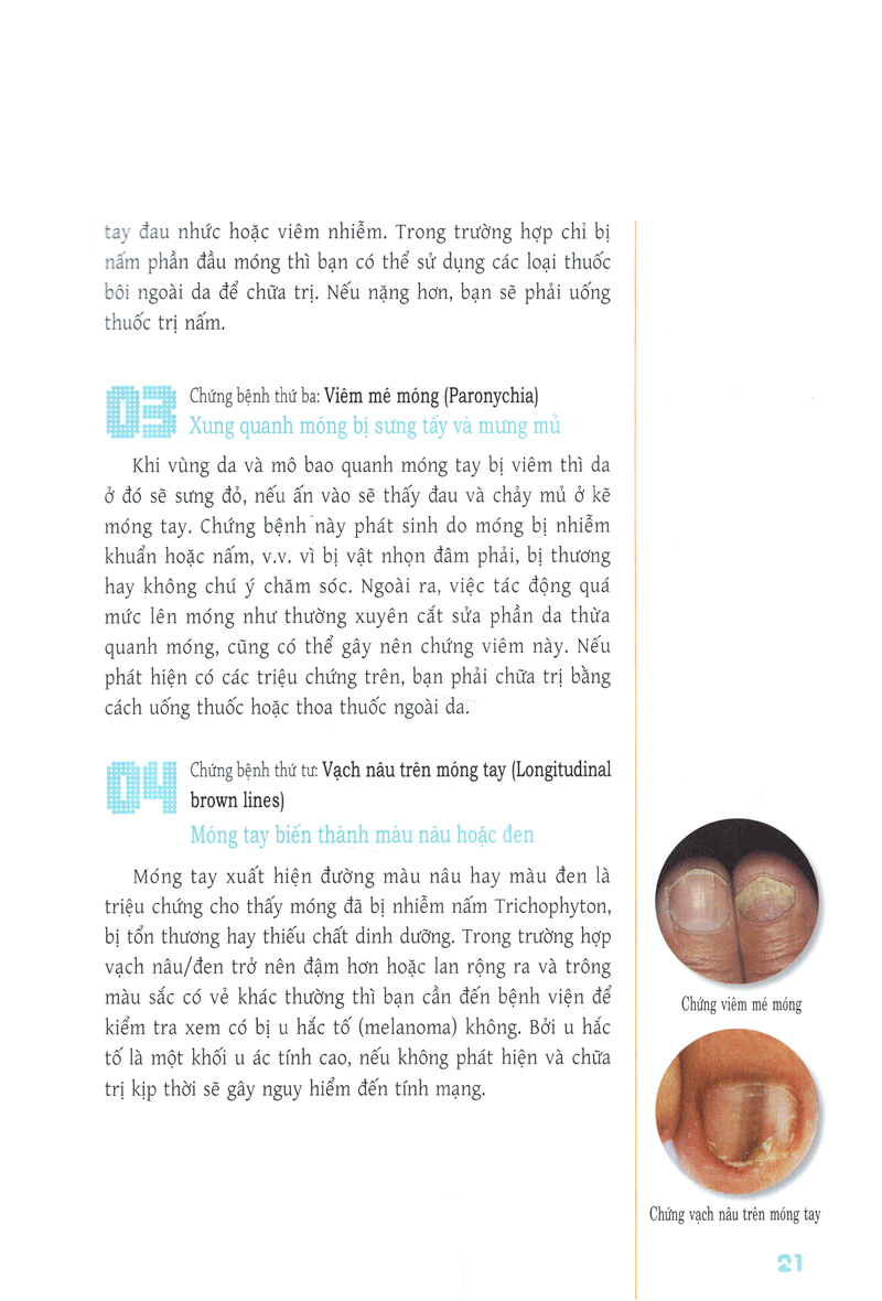 trang điểm móng - cách thể hiện bản thân của những cô gái tự tin