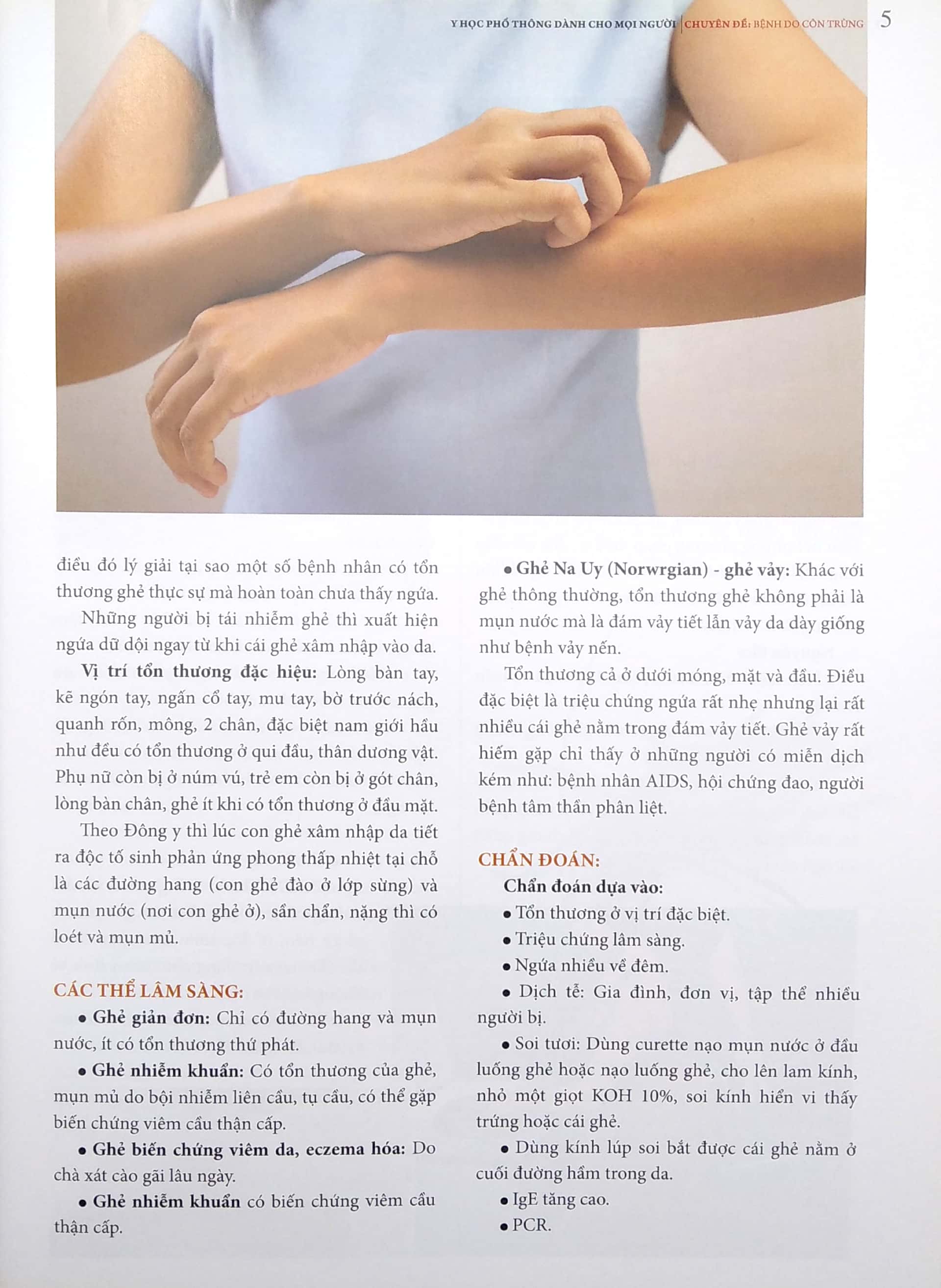 y học phổ thông dành cho mọi người - chuyên đề: bệnh do côn trùng