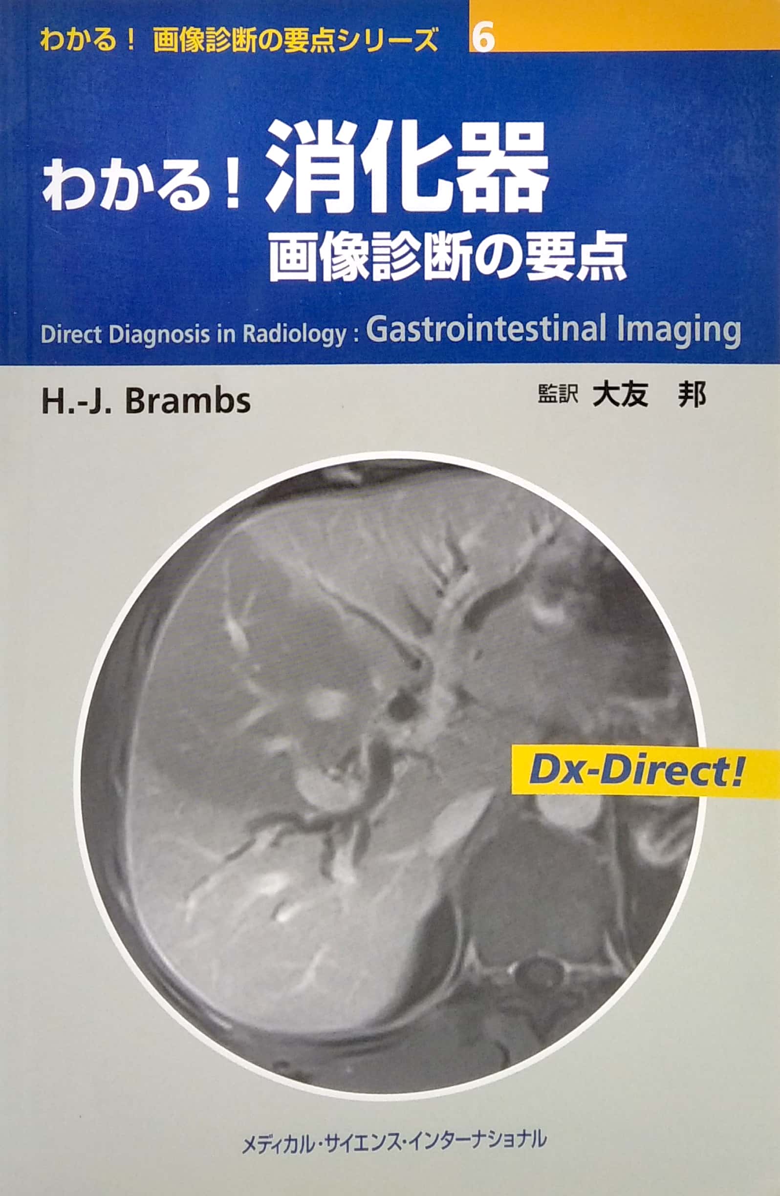 わかる! 画像診断の要点シリーズ6 わかる! 消化器 画像診断の要点 (わかる!画像診断の要点シリーズ) wakaru! shouka ki gazou shindan no youten