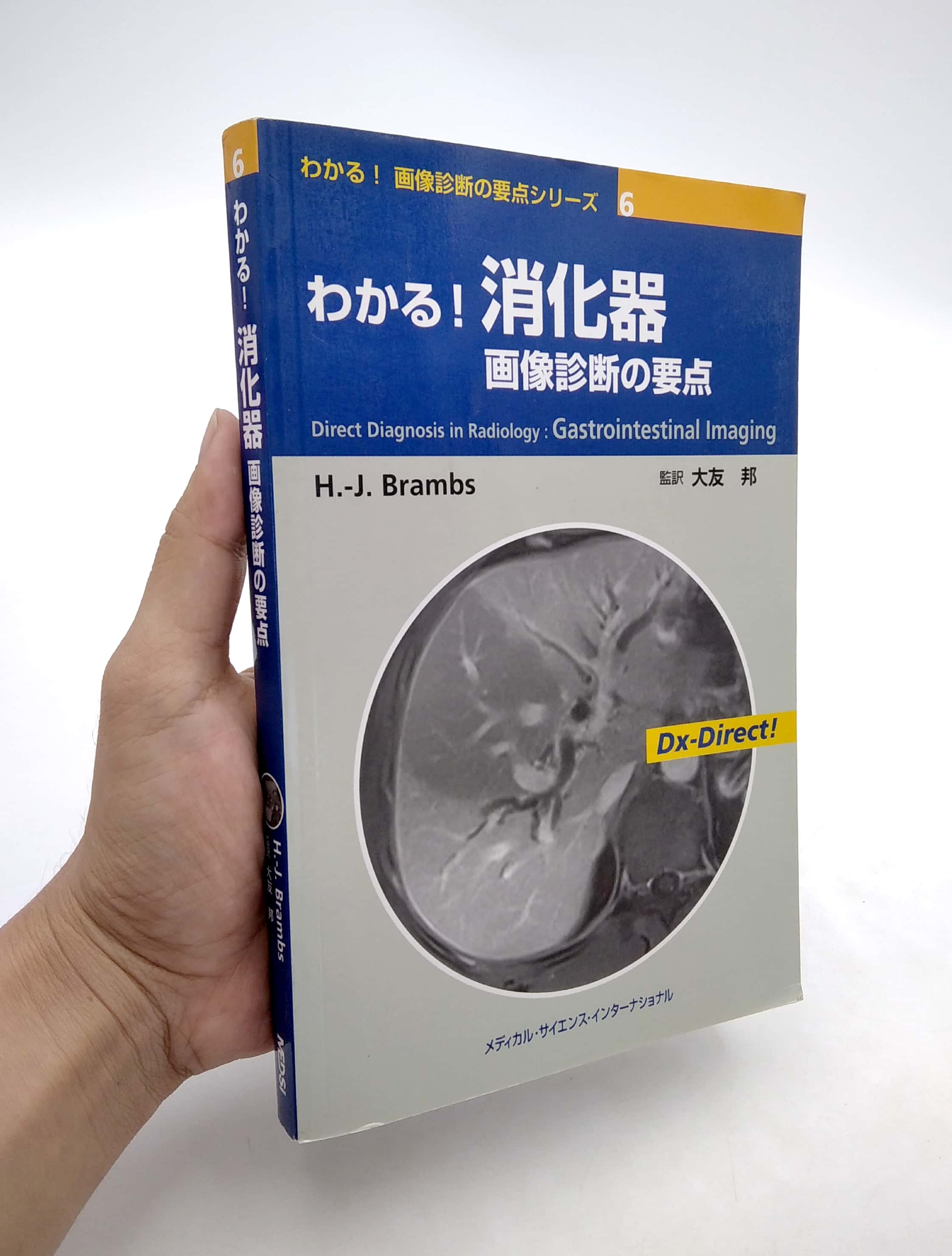 わかる! 画像診断の要点シリーズ6 わかる! 消化器 画像診断の要点 (わかる!画像診断の要点シリーズ) wakaru! shouka ki gazou shindan no youten