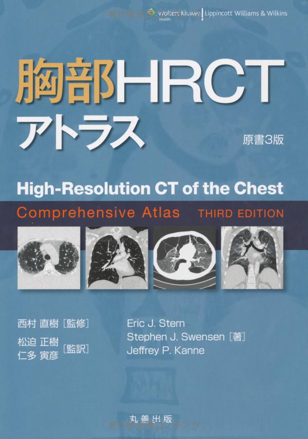 胸部 hrct アトラス - high-resolution ct of the chest comprehensive atlas