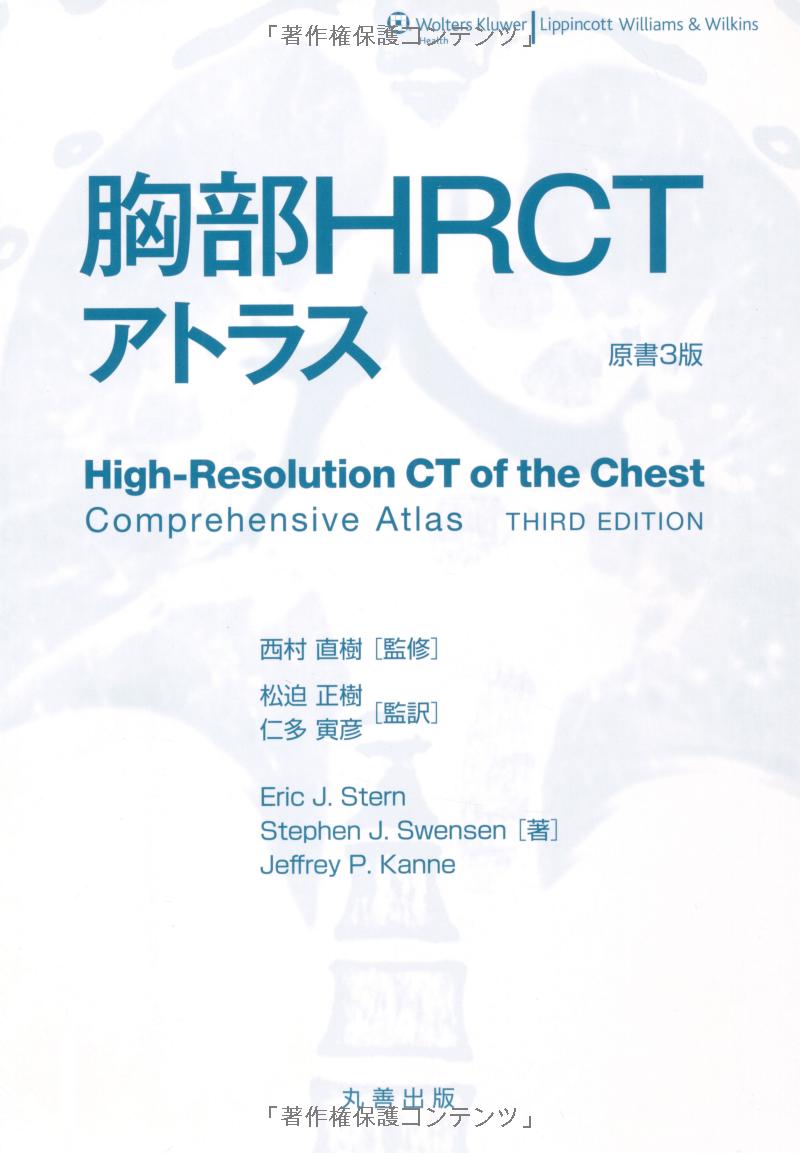 胸部 hrct アトラス - high-resolution ct of the chest comprehensive atlas